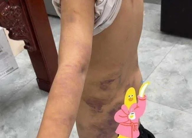 Hưng Yên: Làm rõ nghi vấn nhóm bé trai bị bạo hành