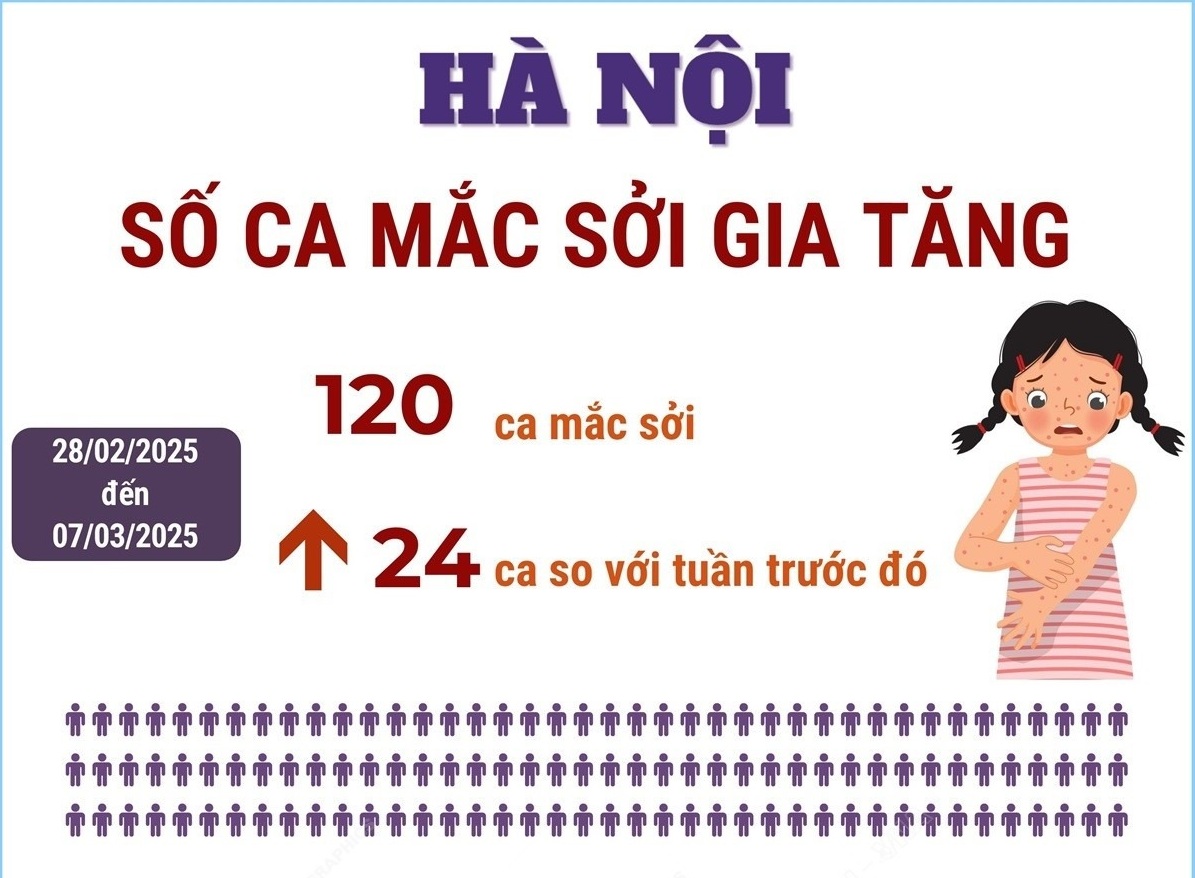 CDC Hà Nội: Số ca mắc sởi tại Thủ đô gia tăng