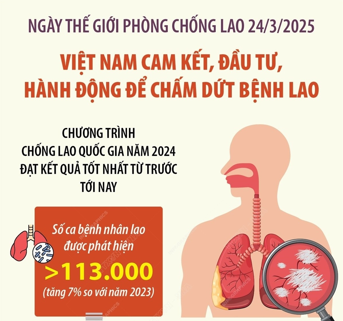 Việt Nam cam kết, đầu tư, hành động để chấm dứt bệnh lao